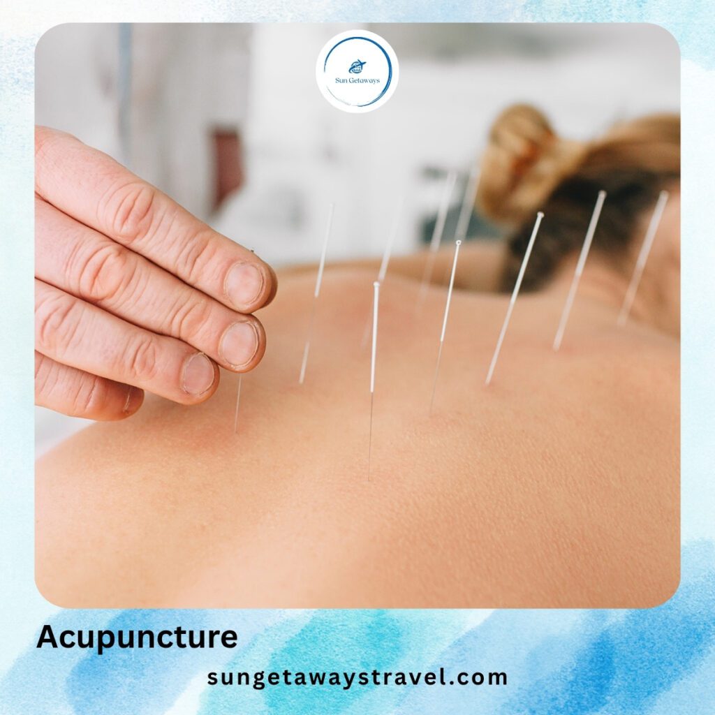 Acupuncture