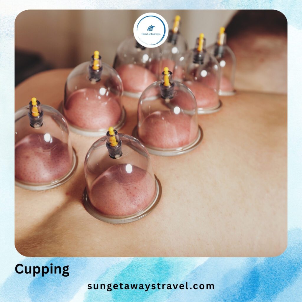 Cupping